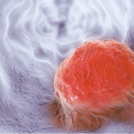 AI Tool Predicts Cancer Patients' Response to Immunotherapy