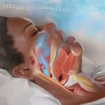 Australian Study Unveils Link Between Snoring and High Blood Pressure