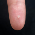 Chinese Researchers Develop Injectable Hydrogel Sensor for Safer Brain Monitoring