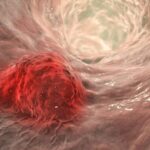 Chinese_Researchers_Discover_Probiotic_Therapy_for_Colorectal_Cancer