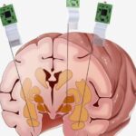 Chinese Scientists Pioneer Neural Probe Recording in Macaque Brain