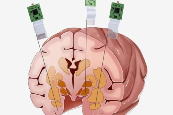 Chinese Scientists Pioneer Neural Probe Recording in Macaque Brain Chinese Scientists Pioneer Neural Probe Recording in Macaque Brain