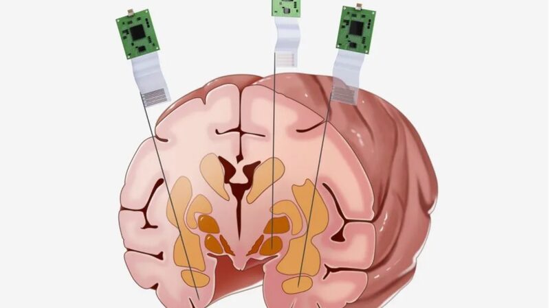 Chinese_Scientists_Pioneer_Neural_Probe_Recording_in_Macaque_Brain - Khabar Asia Chinese Scientists Pioneer Neural Probe Recording in Macaque Brain
