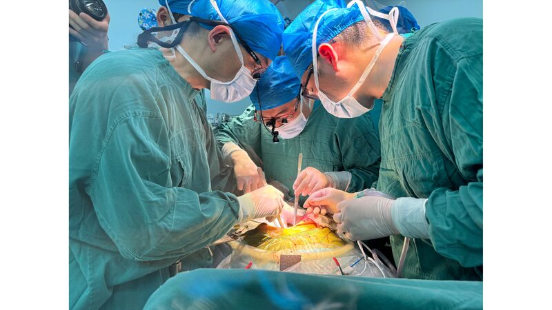 Chinese_Surgeons_Achieve_Worlds_First_Live_Pig_Liver_Transplant - Khabar Asia Chinese Surgeons Achieve World's First Live Pig Liver Transplant