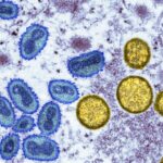 DRC_Declares_Mpox_Outbreak_a_Continental_Emergency_After_570_Deaths