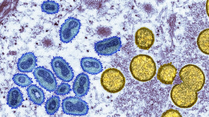 DRC_Declares_Mpox_Outbreak_a_Continental_Emergency_After_570_Deaths - Khabar Asia DRC_Declares_Mpox_Outbreak_a_Continental_Emergency_After_570_Deaths