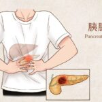 Israeli_Researchers_Develop_Non_Invasive_Therapy_to_Ease_Pancreatic_Cancer_Pain
