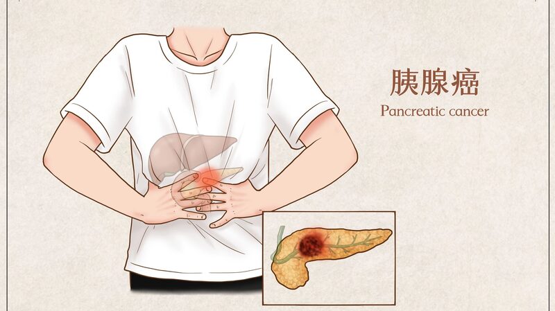 Israeli_Researchers_Develop_Non_Invasive_Therapy_to_Ease_Pancreatic_Cancer_Pain