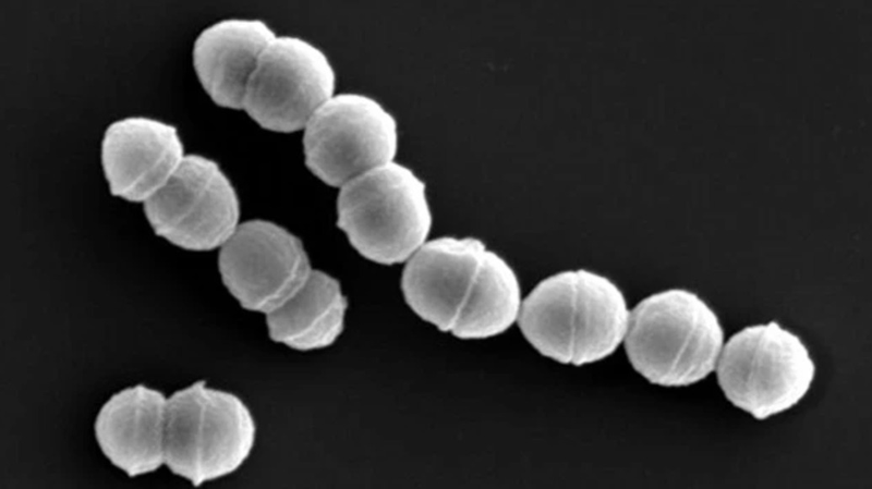 Japan_Reports_Over_1_100_Cases_of__Flesh_Eating_Bacteria__Infections - Khabar Asia Japan_Reports_Over_1_100_Cases_of__Flesh_Eating_Bacteria__Infections