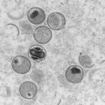 Jordan_Reports_First_Mpox_Case_of_2024