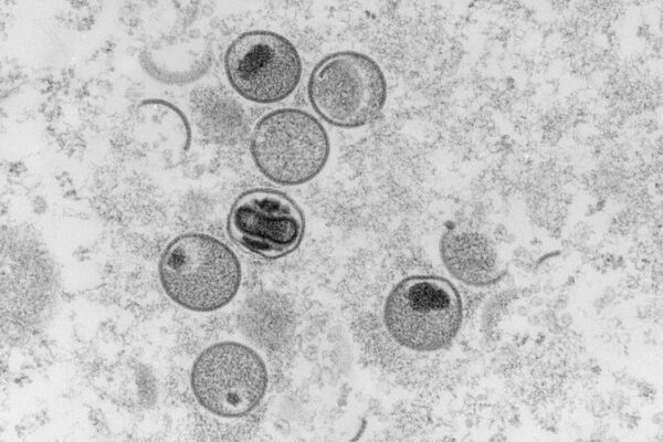 Jordan Reports First Mpox Case of 2024 Jordan_Reports_First_Mpox_Case_of_2024