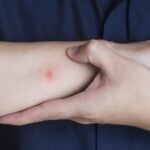 NYC_Launches_Mosquito_Spraying_Amid_West_Nile_Virus_Concerns