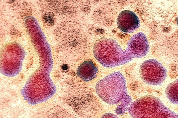 Single H5N1 Mutation Could Enable Easier Human Infection, Study Finds Single_H5N1_Mutation_Could_Enable_Easier_Human_Infection__Study_Finds