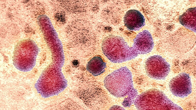 Single_H5N1_Mutation_Could_Enable_Easier_Human_Infection__Study_Finds