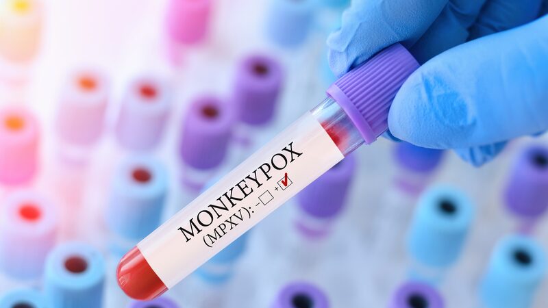 WHO_Approves_First_Global_Mpox_Vaccine__Boosting_Fight_Against_Outbreaks - Khabar Asia WHO_Approves_First_Global_Mpox_Vaccine__Boosting_Fight_Against_Outbreaks