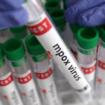 WHO_Reports_Rising_Mpox_Outbreaks_in_Africa_with_Global_Spread