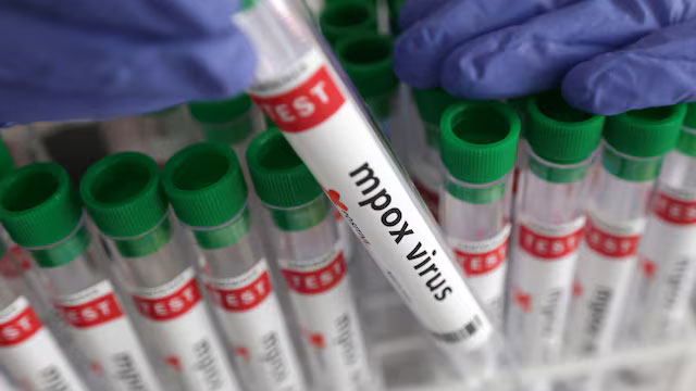 WHO_Reports_Rising_Mpox_Outbreaks_in_Africa_with_Global_Spread - Khabar Asia WHO_Reports_Rising_Mpox_Outbreaks_in_Africa_with_Global_Spread