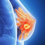 Cancer_Dormancy_Breakthrough_Sparks_Hope_for_New_Treatments - Khabar Asia Cancer_Dormancy_Breakthrough_Sparks_Hope_for_New_Treatments