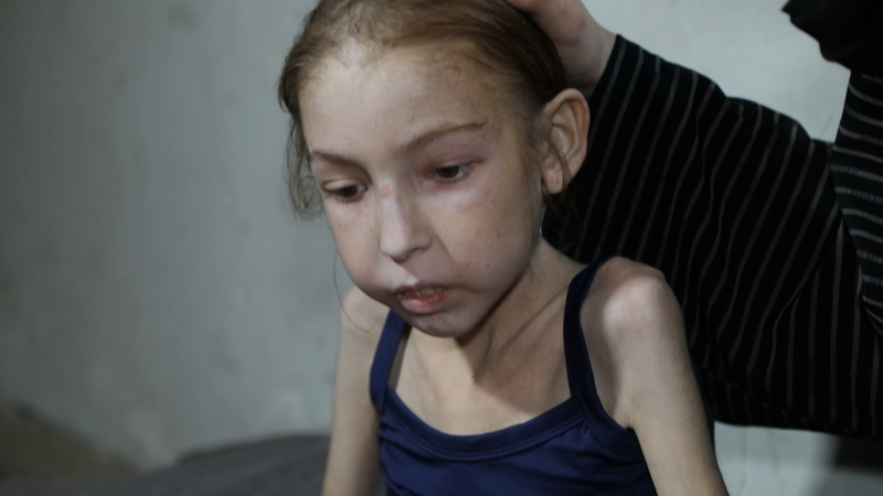 Gaza’s Silent Crisis: A Child’s Plea for Normalcy Amidst Hunger Gaza_s_Silent_Crisis__A_Child_s_Plea_for_Normalcy_Amidst_Hunger video poster