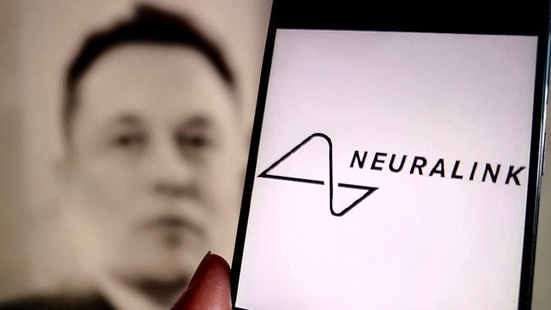 Neuralink’s Brain Implants Reach Seven Patients: A New Era in Medical Tech? Neuralink_s_Brain_Implants_Reach_Seven_Patients__A_New_Era_in_Medical_Tech_