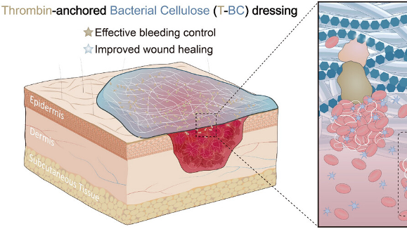 Chinese Scientists Develop Breakthrough Burn Dressing Using Bacterial Cellulose Chinese_Scientists_Develop_Breakthrough_Burn_Dressing_Using_Bacterial_Cellulose
