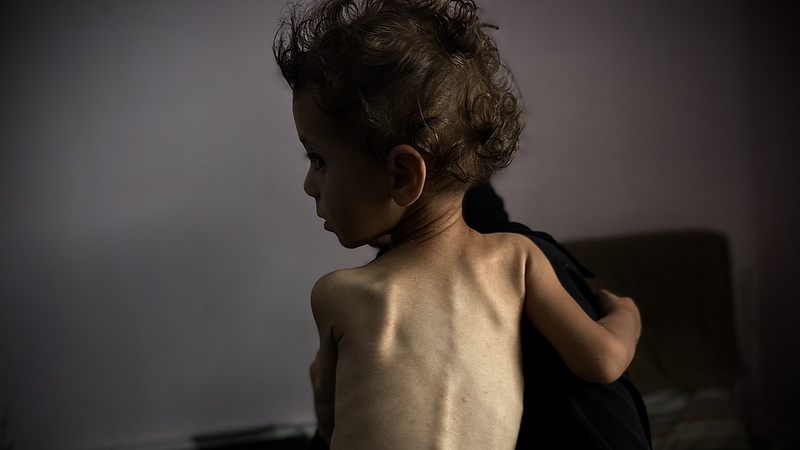 Gaza_Faces__Man_Made__Famine__UN_Report_Sounds_Alarm - Khabar Asia Gaza_Faces__Man_Made__Famine__UN_Report_Sounds_Alarm