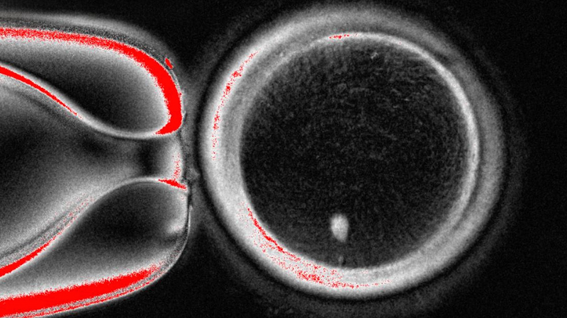 Breakthrough: Human Eggs Created from Skin Cells in Lab Study Breakthrough__Human_Eggs_Created_from_Skin_Cells_in_Lab_Study