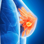 Breastfeeding_Boosts_Immune_Defense_Against_Breast_Cancer__Study