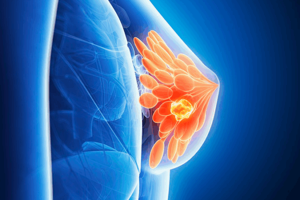 Breastfeeding Boosts Immune Defense Against Breast Cancer: Study Breastfeeding_Boosts_Immune_Defense_Against_Breast_Cancer__Study