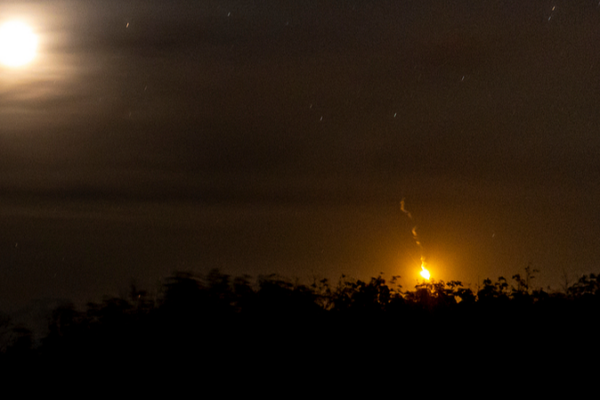 Chinese_National_Injured_in_Cambodia_Thailand_Border_Clashes