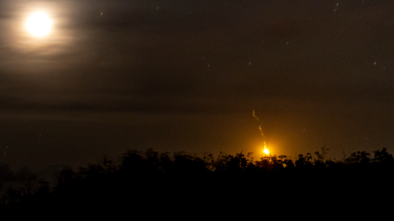 Chinese_National_Injured_in_Cambodia_Thailand_Border_Clashes