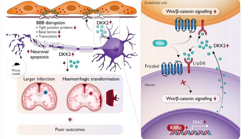 Chinese_Researchers_Uncover_Key_Mechanism_in_Post_Stroke_Brain_Injury