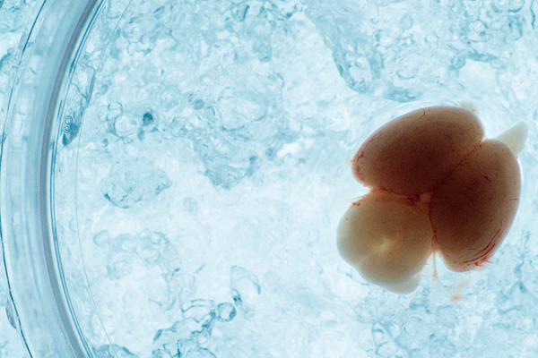 Chinese_Scientists_Unveil_Breakthrough_in_Live_Embryonic_Brain_Imaging