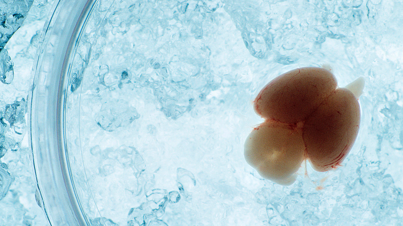 Chinese_Scientists_Unveil_Breakthrough_in_Live_Embryonic_Brain_Imaging