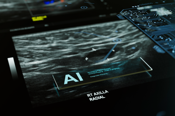 AI_Boosts_Breast_Cancer_Detection_in_Landmark_Swedish_Trial