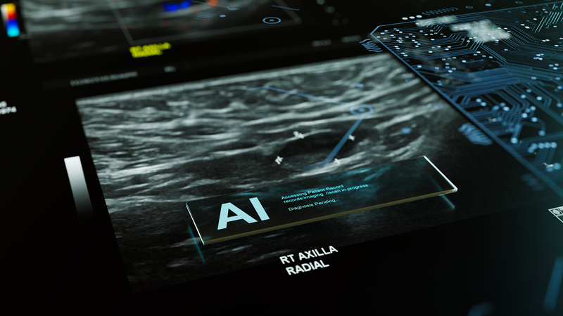 AI_Boosts_Breast_Cancer_Detection_in_Landmark_Swedish_Trial