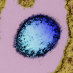 China_Bolsters_Nipah_Virus_Preparedness_Amid_Regional_Outbreak