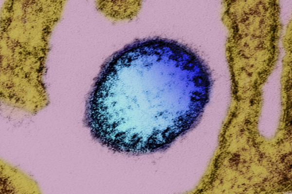 China_Bolsters_Nipah_Virus_Preparedness_Amid_Regional_Outbreak