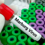 Ethiopia_Successfully_Contains_First_Marburg_Virus_Outbreak__WHO_Confirms