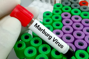 Ethiopia_Successfully_Contains_First_Marburg_Virus_Outbreak__WHO_Confirms