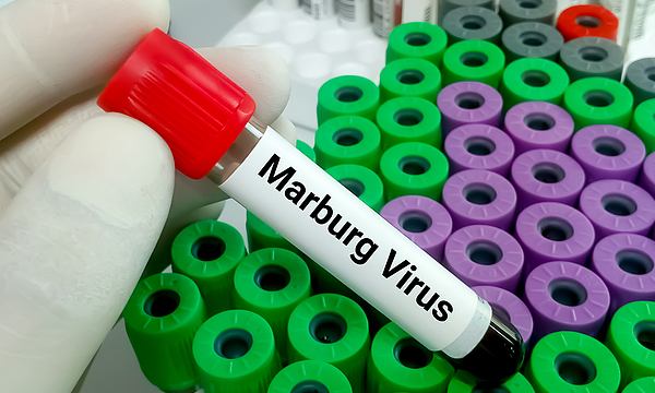 Ethiopia_Successfully_Contains_First_Marburg_Virus_Outbreak__WHO_Confirms