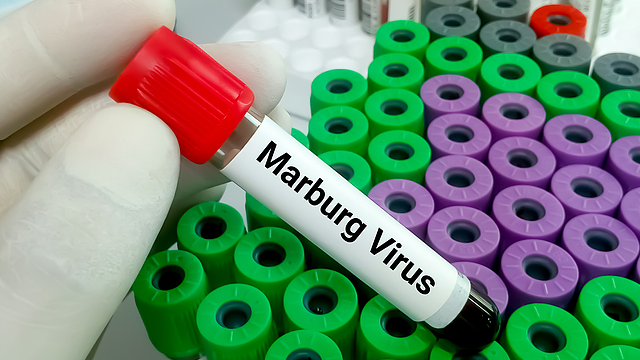 Ethiopia_Successfully_Contains_First_Marburg_Virus_Outbreak__WHO_Confirms