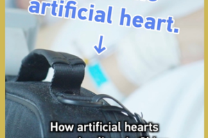 Artificial_Hearts_Revolutionize_Cardiac_Care_in_China video poster