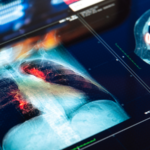 Artificial_Lung_Breakthrough_Saves_Patient_in_48_Hour_Transplant_Race