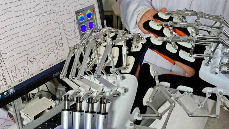 Brain_Computer_Interface_Breakthrough_Restores_Vision_in_Blind_Patient