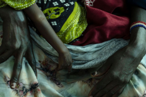 Severe_Drought_Threatens_Kenyan_Children_as_Livelihoods_Collapse