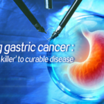 Gastric_Cancer_No_Longer_a__Silent_Killer__with_Modern_Treatments_poster - Khabar Asia Gastric_Cancer_No_Longer_a__Silent_Killer__with_Modern_Treatments video poster