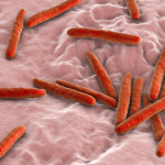 South_Africa_s_Breakthrough_Handheld_TB_Detector_Promises_Faster_Diagnosis