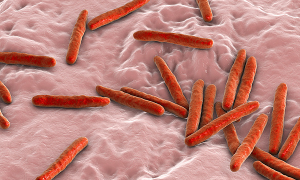 South_Africa_s_Breakthrough_Handheld_TB_Detector_Promises_Faster_Diagnosis