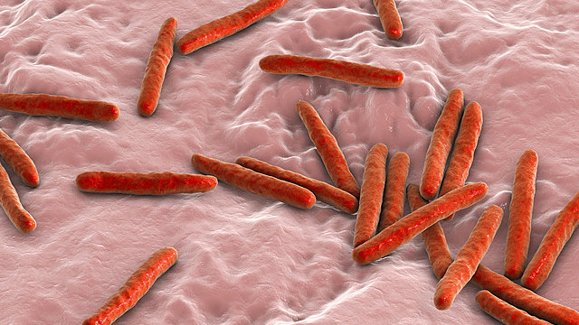 South_Africa_s_Breakthrough_Handheld_TB_Detector_Promises_Faster_Diagnosis